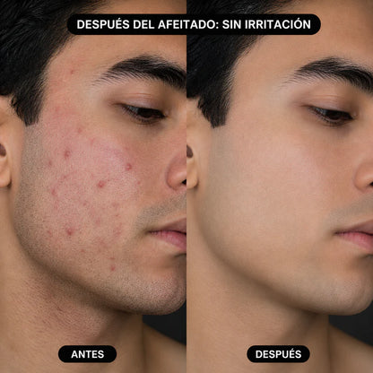 Limpiador Premiun de Afeitadorar