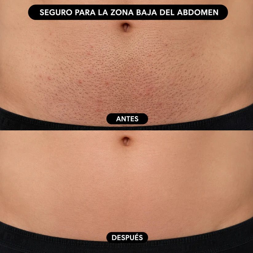 Limpiador Premiun de Afeitadorar